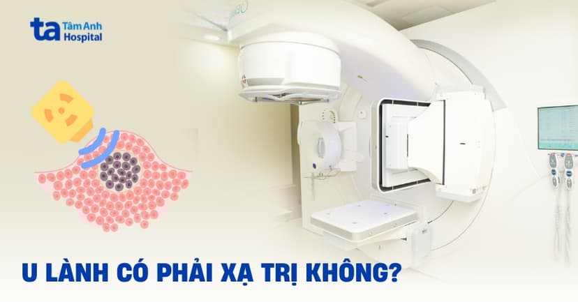 Answer: Do benign tumors require radiation therapy?